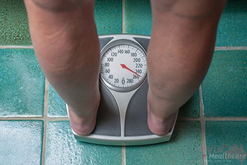 Over Weight / Obesity Ayurveda Treatment Sydney Australia - AyurHealthCare