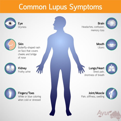 Ayurvedic Treatment for LUPUS - Ayur Healthcare