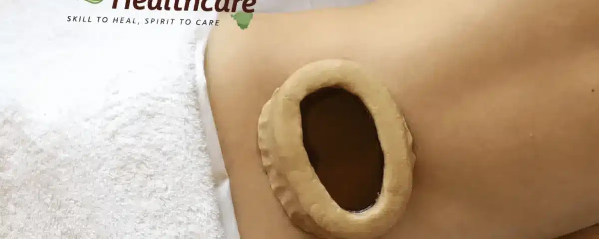 Katibasti Treatment
