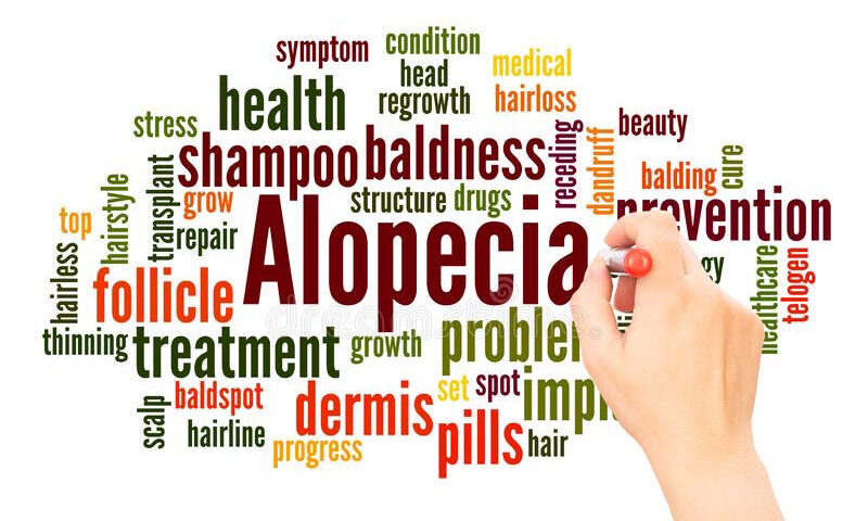 alopecia in Ayurveda