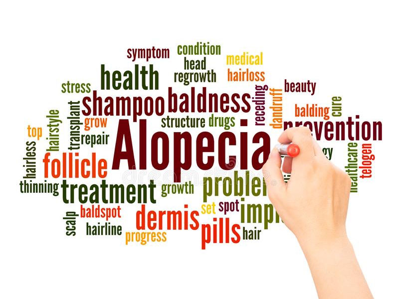 alopecia in Ayurveda