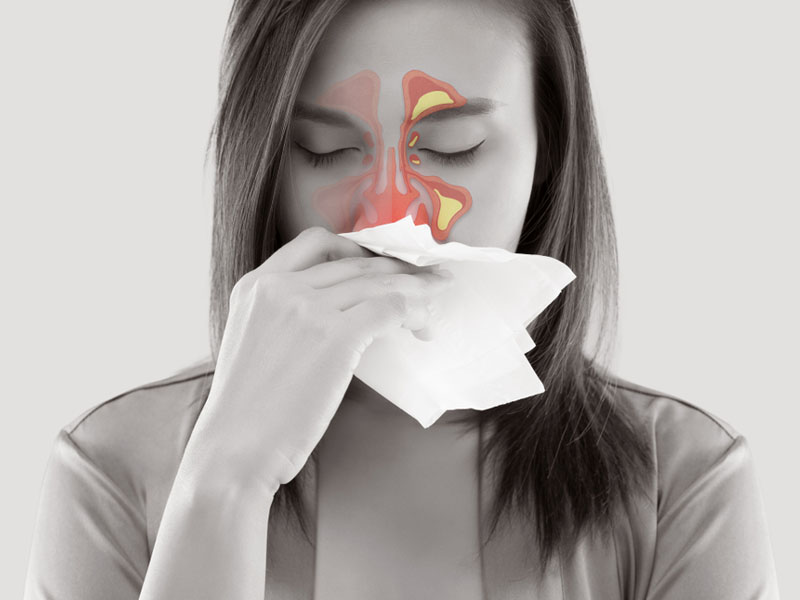 cold-cough-sinusitis