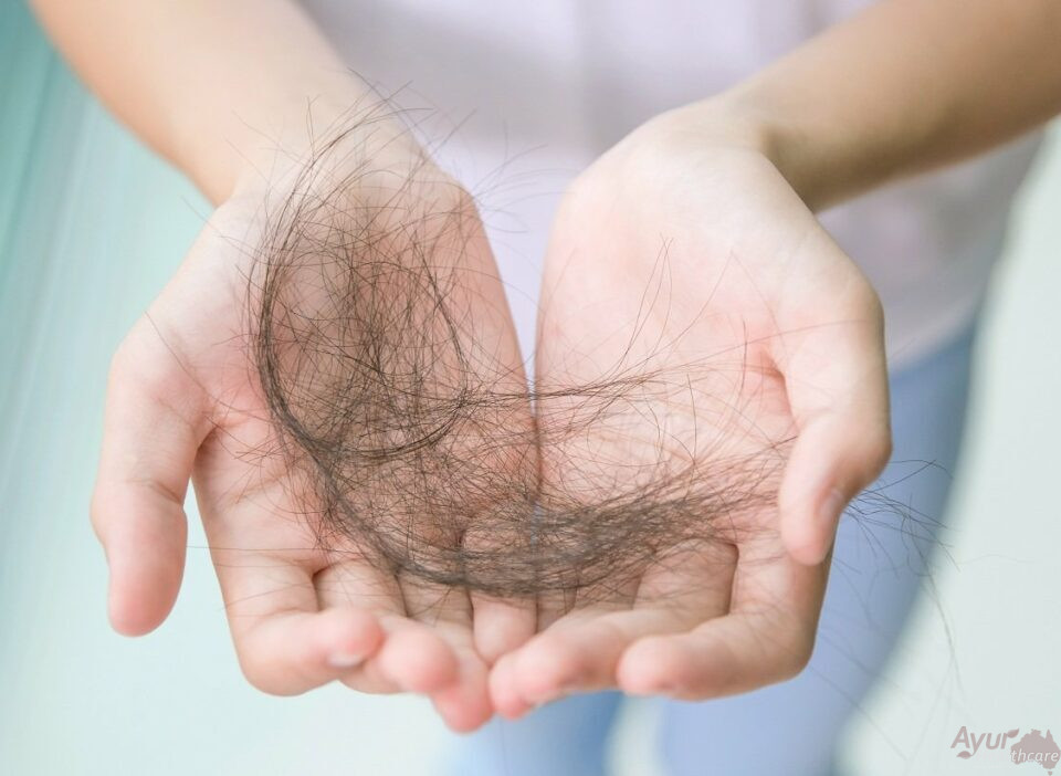 Hair loss - Homeopathy